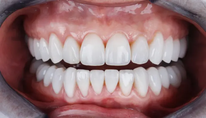 Dental pain relief with a professional approach